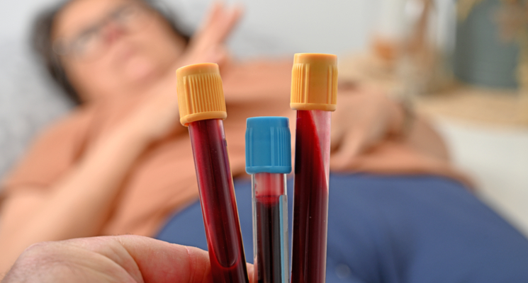 get your blood test at home in Sharjah