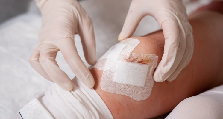 Signs of Wound Infection When to Get Nurse-at-Home Care in Dubai