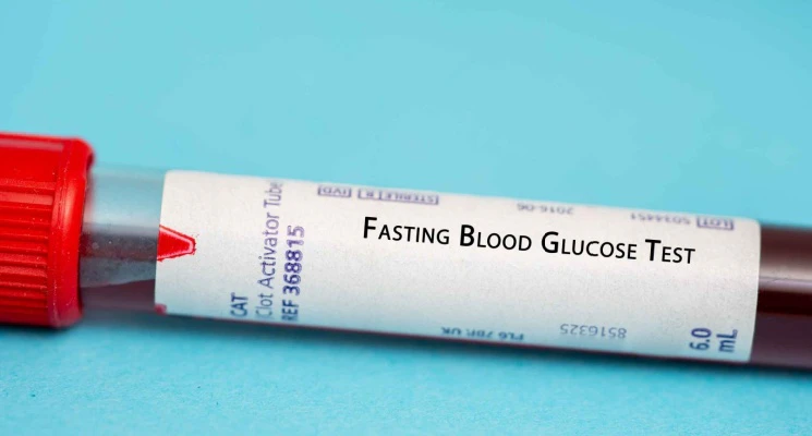 Blood Test Guidelines in Dubai 8 Tests That Require Fasting